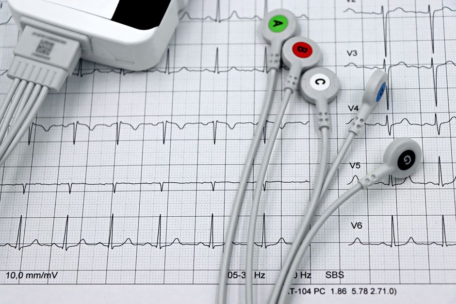 how to determine heart rate